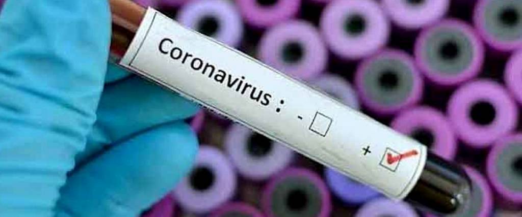 Vigoplan | Coronavirus Galicia