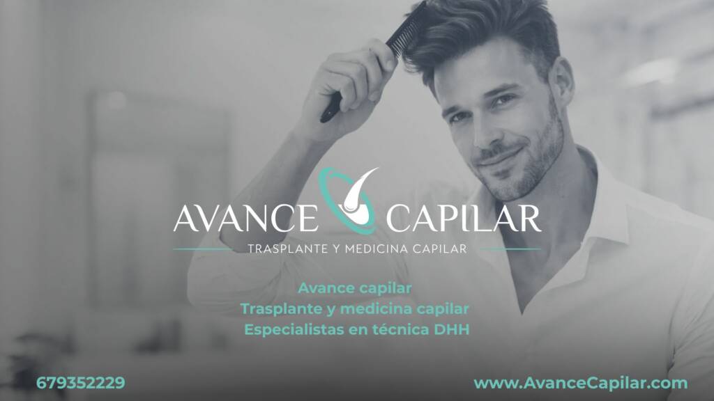 Vigoplan | Avance Capilar 1920 X 1080 (3)